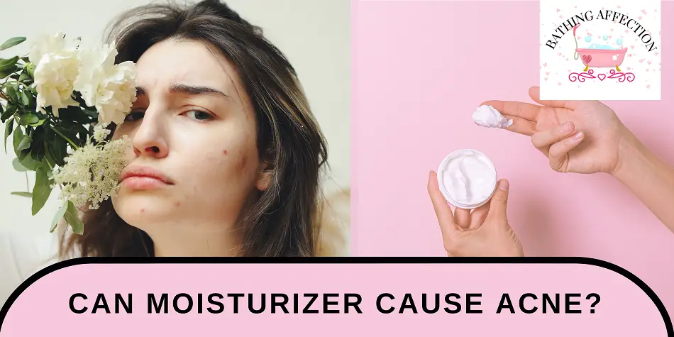 can-moisturizer-cause-acne-bathing-affection